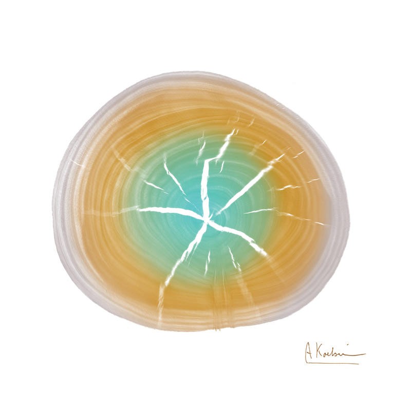 Albert Koetsier, RINGS ORANGE I (X-RAY)