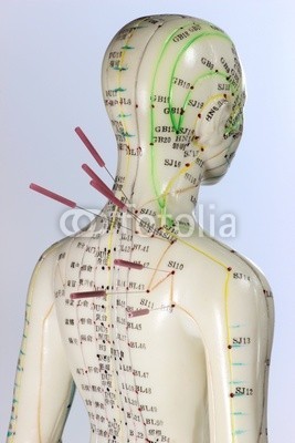 B. Wylezich, Akupunktur04 (akupunktur, rücken, schultern, typen, üben, aufgaben, lernen, schulung, medizin, traditionell, chinese, heilpraktiker, meridian, naturheilkunde, punktieren, naturheilkunde, körper, frau, weiblich, doktor, chirurgie, schmerz, schmerzen, heilkund)