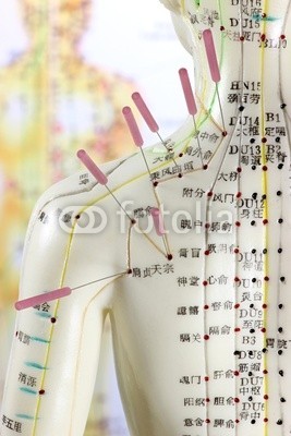 B. Wylezich, Akupunktur08 (akupunktur, rücken, schultern, typen, üben, aufgaben, lernen, schulung, medizin, traditionell, chinese, heilpraktiker, meridian, naturheilkunde, punktieren, naturheilkunde, körper, frau, weiblich, doktor, chirurgie, schmerz, schmerzen, heilkund)