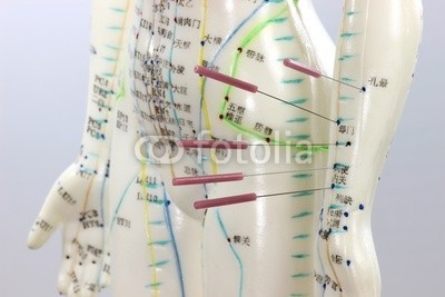 B. Wylezich, Akupunktur06 (akupunktur, typen, üben, aufgaben, lernen, schulung, medizin, traditionell, chinese, heilpraktiker, meridian, naturheilkunde, punktieren, naturheilkunde, körper, frau, weiblich, doktor, chirurgie, schmerz, schmerzen, heilkunde, bedienung, therapi)