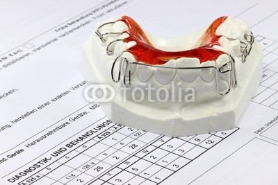 B. Wylezich, Zahnspange02 (strebe, bedienung, behandeln, kieferorthopäde, kieferorthopädie, lose, griffe, klammern, zahnheilkunde, medizin, ärztin, plastik, schecke, konto, kosten, krankenkasse, versicherung, zahn, typen, kostenvoranschla)